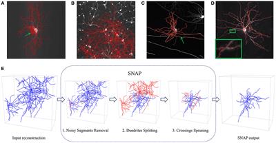 SNAP: a structure-based neuron morphology reconstruction automatic pruning pipeline